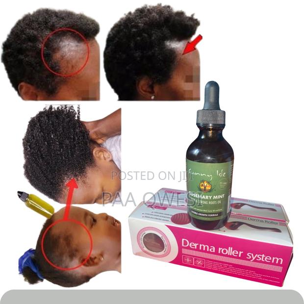 Perfect Combo for Hair Regrowth · Photo 2