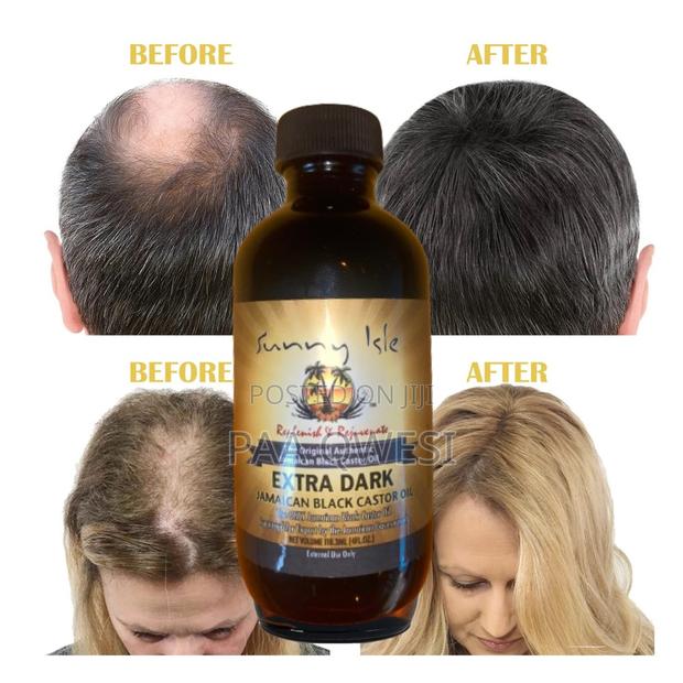 Purely Original Castor Oil for Hair Growth. · Photo 2