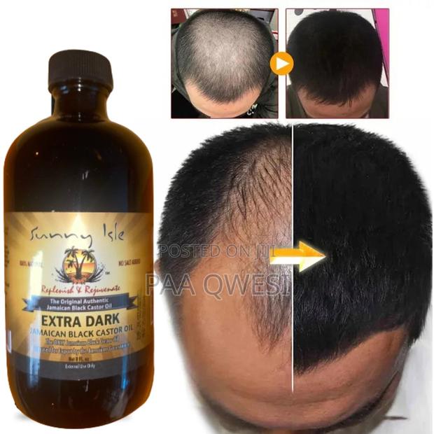 Castor Oil { General Hair Growth Product] · Photo 2