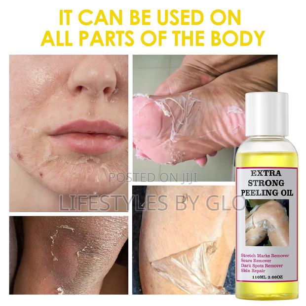 Extra Strong Peeling Oil (Exfoliating Body Oil) · Photo 3