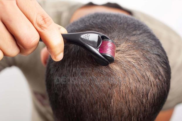 Derma Roller for Growing Hair · Photo 2