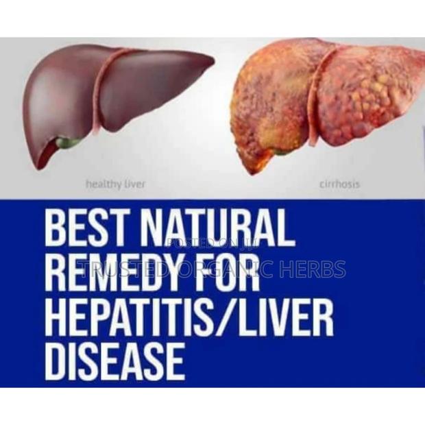 Best Natural Remedy for Hepatitis/ Liver/Kidney Disease · Photo 2