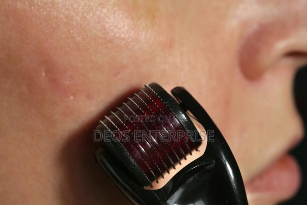 0.5mm Derma Roller for Facial · Photo 2