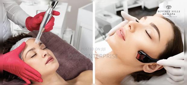 540 Microneedlings of Derma Roller · Photo 2