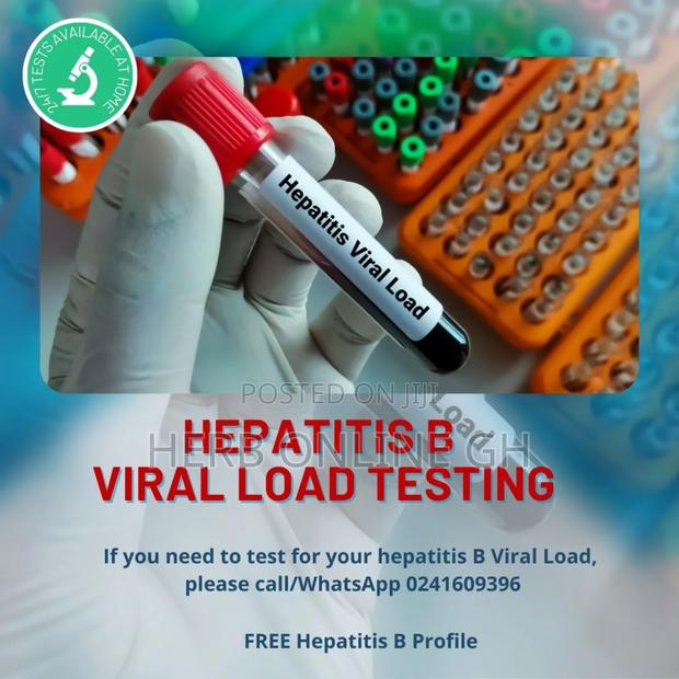 Hepatitis B Viral Load Testing · Photo 2