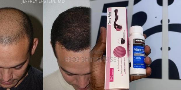 Hair Growth-Kirkland Minoxidil for Baldness Growth · Photo 2