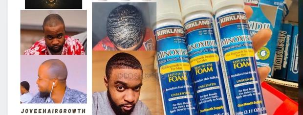 Kirkland Minoxidil Foam for Hair and Baldness Growth · Photo 2