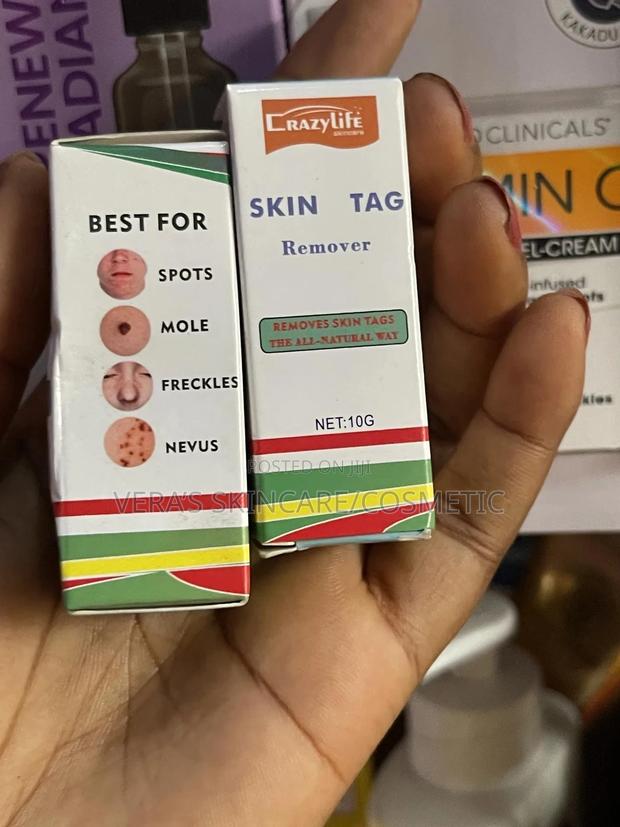 Skin Tag Removal · Photo 2