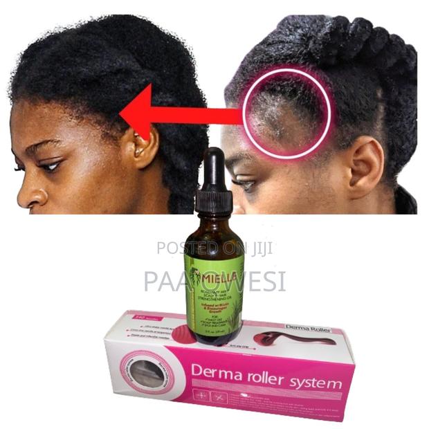 Mielle Rosemary Mint for Hair Growth · Photo 2