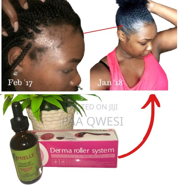 Mielle With Derma Perfect to Grow Edges · Photo 2