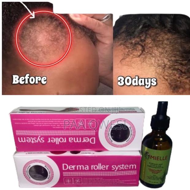 Mielle Derma Roller for Perfect Hair Growth · Photo 2