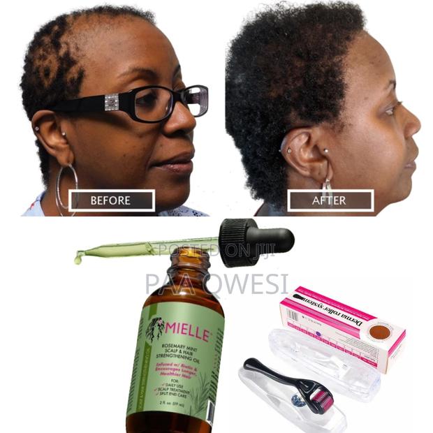 Super Hair Growth Combo(Mielle Rosemary Mint Roller) · Photo 2