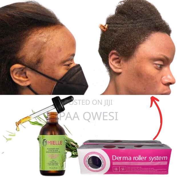 {Mielle Derma Roller} Super Hairline Loss Regrowth · Photo 2