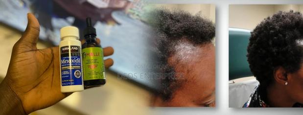Kirkland Minoxidil Mielle Rosemary Mint for Hair Growth · Photo 2