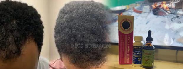 Kirkland Minoxidil Mielle Roller for Hair Baldness · Photo 2