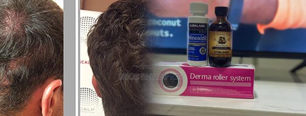 Massive Kirkland Roller Castor Oil for Hair Growth · Photo 2
