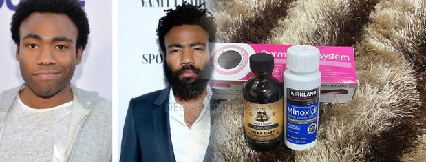 Great Super Combo for Beard Baldness Growth · Photo 2
