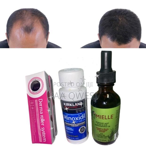 Roller , Kirkland Mielle for Hair Loss Regrowth · Photo 2