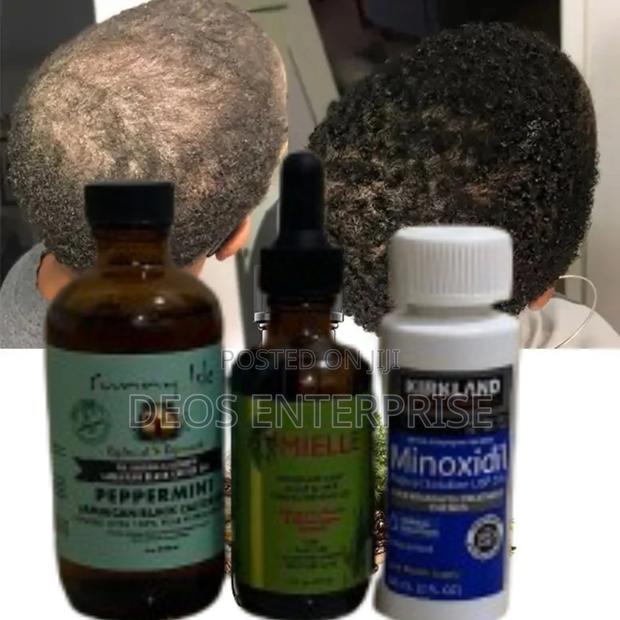 Effective Combo of Kirkland Mielle Peppermint for Hair · Photo 2
