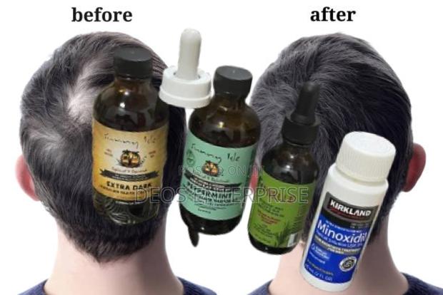 Castor Oil Peppermint Mielle Organics Kirkland · Photo 2