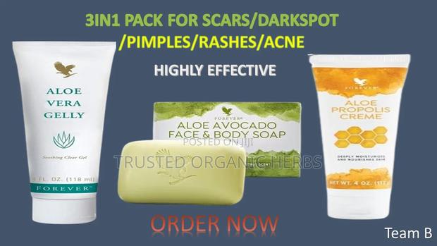 3in1 Pack For Scar/Pimples/Rashes/Acne- Highly Effective · Photo 2