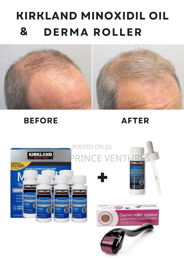Stronger Hair With Minoxidil Oil and Derma Roller Tool