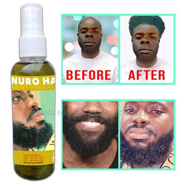 Hair Growth Oil - 100ml ( Nnuro Hair Food ) · Photo 4