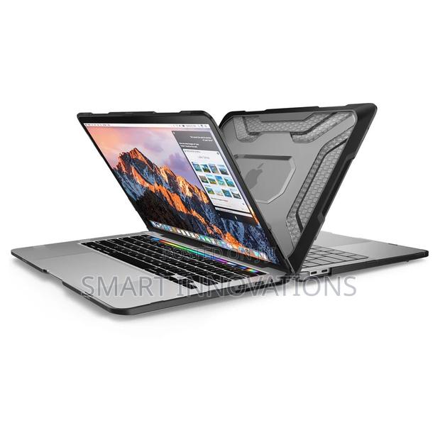 Macbook Pro 13 Inch (2022-2016) Ub Pro Rugged Case photo 3