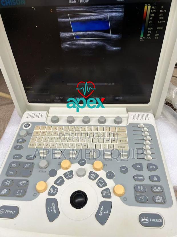 Chison Q5 4d Portable Color Doppler Ultrasound + 3 Probes