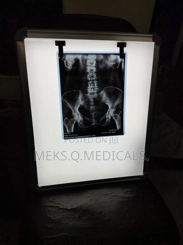 X- Ray View Box Single · Photo 4