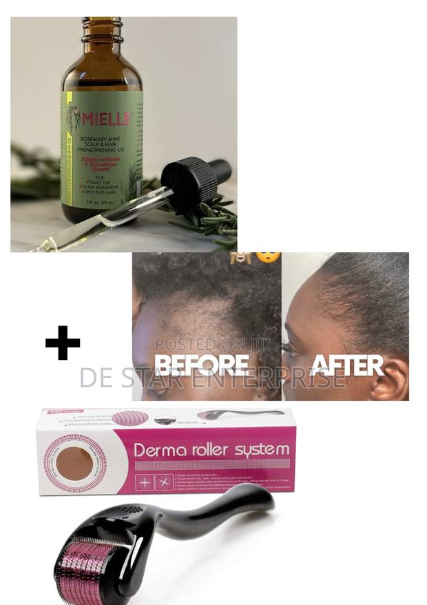 Mielle Rosemary Oil + Derma Roller System for Edges · Photo 2