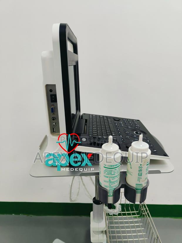 Brandnew Sonotec Dp-30 Digital Ultrasound System + Trolley · Photo 4