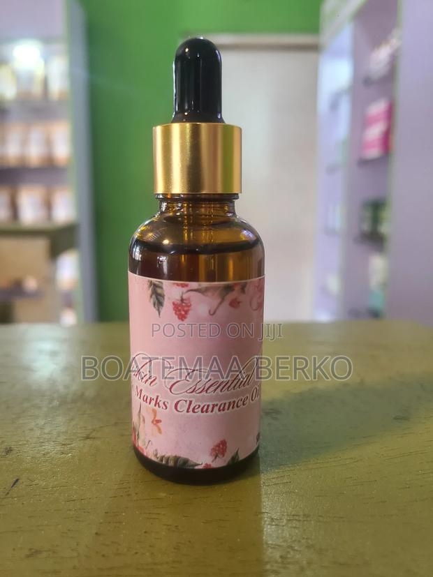 Stretch Marks Oil · Photo 4