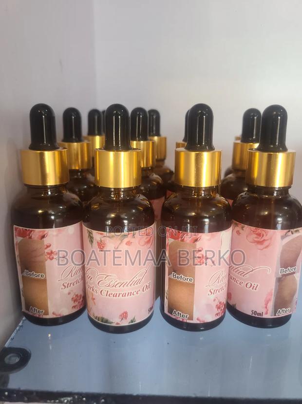 Stretch Marks Oil · Photo 3