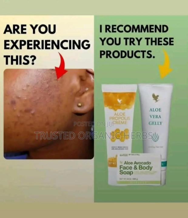 Best Skincare Combo - Acne Solution