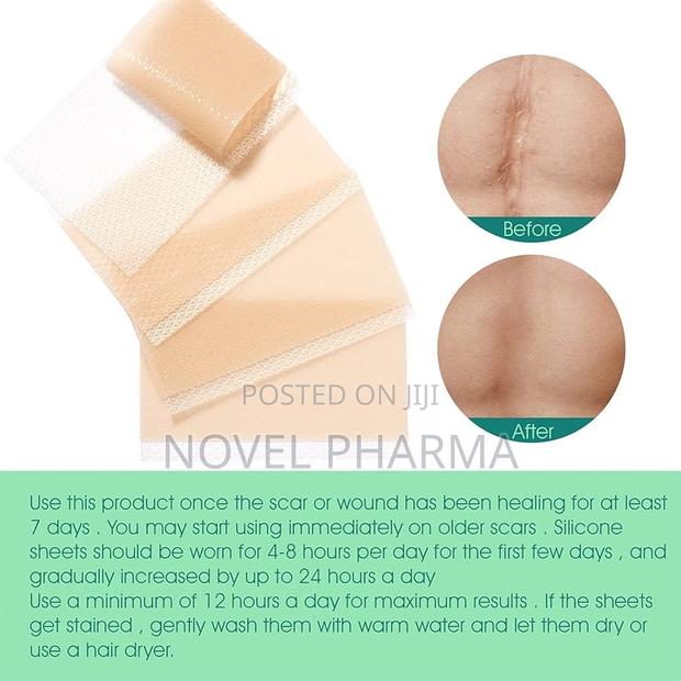 Silicone Scar Sheet photo 8