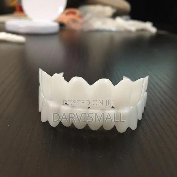 Fake Veneers Teeth photo 2