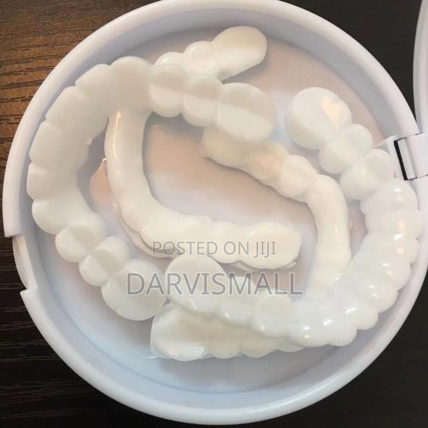 Fake Veneers Teeth photo 4