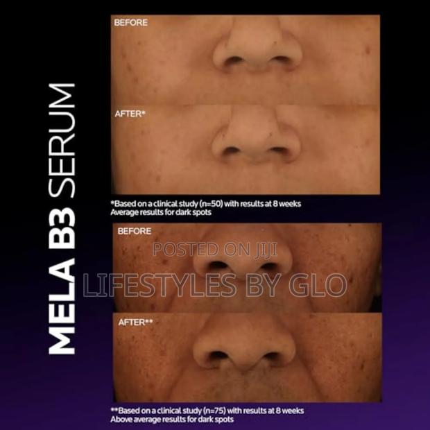Mela B3 Dark Spot Serum With Melasyl + Niacinamide Serum photo 2