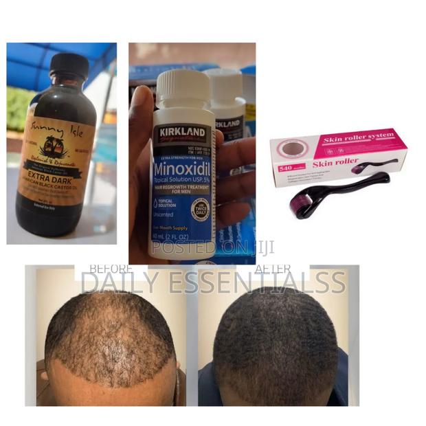 Full Hair Regrowth Combo Pack · Photo 2