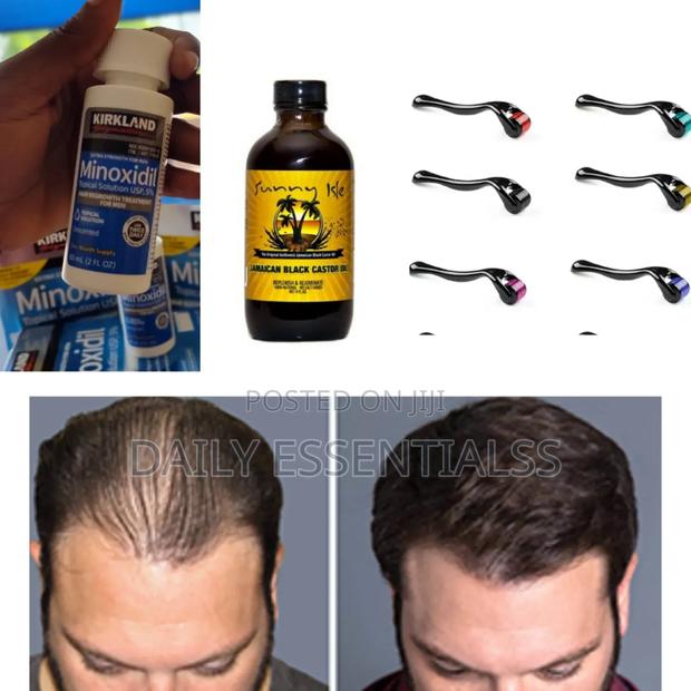Hair Rescue Bundle – Fast Results · Photo 2