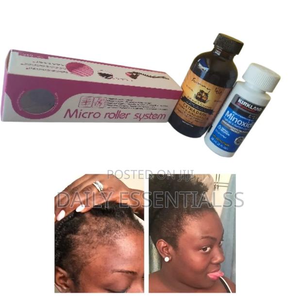 Kirkland Hair Boost + Natural Oil Therapy · Photo 2