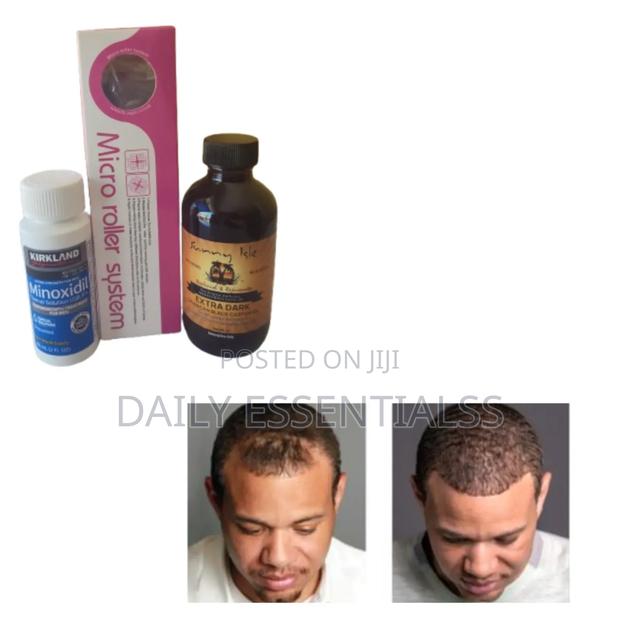Men Women Hair Growth Kit · Photo 2