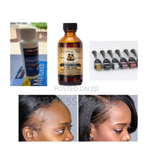 Advanced Hair Regrowth Combo (Best Seller) · Photo 2