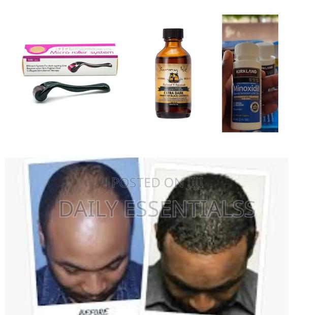 Power Growth Pack – Edges, Crown Beards · Photo 2