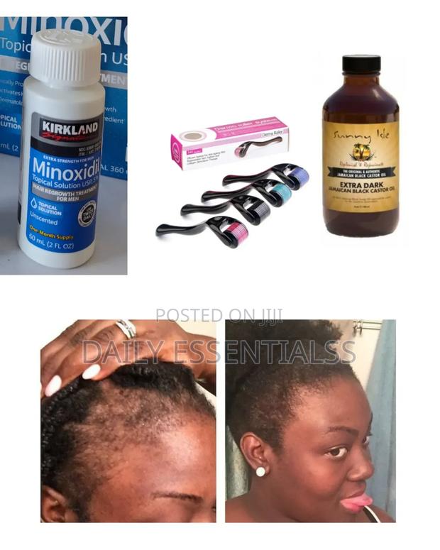 Hair Growth Essentials Kit · Photo 2