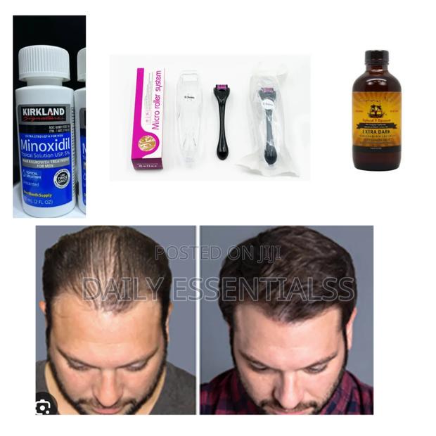 Balding? Thinning? This Set Is for You! · Photo 2