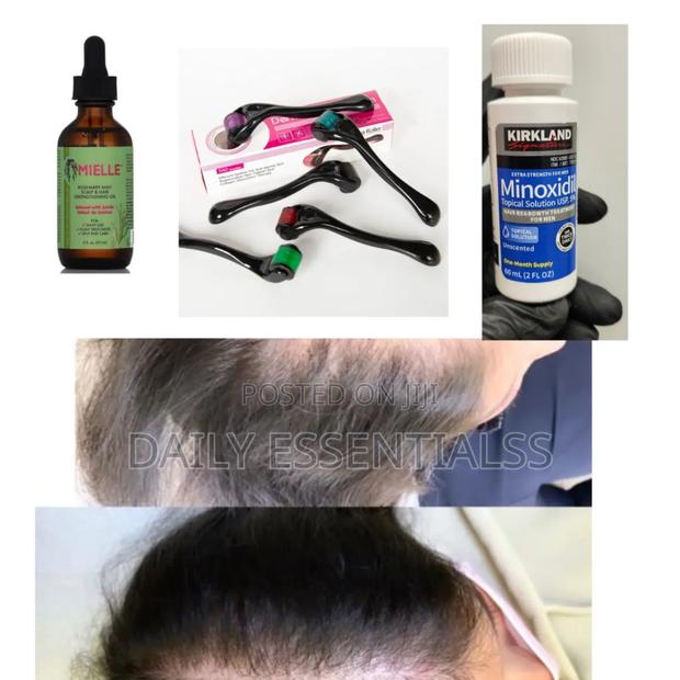 Kirkland X Mielle X Derma Roller Growth Combo · Photo 2