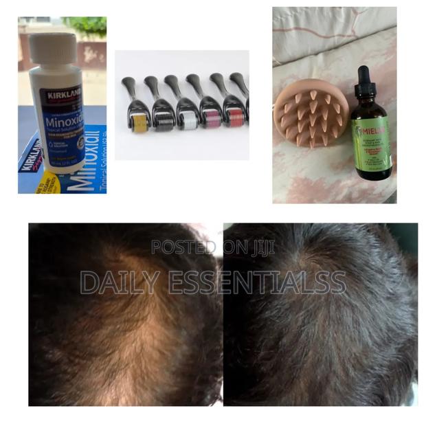Full Beard Hair Kit: Kirkland, Mielle Derma Roller · Photo 2