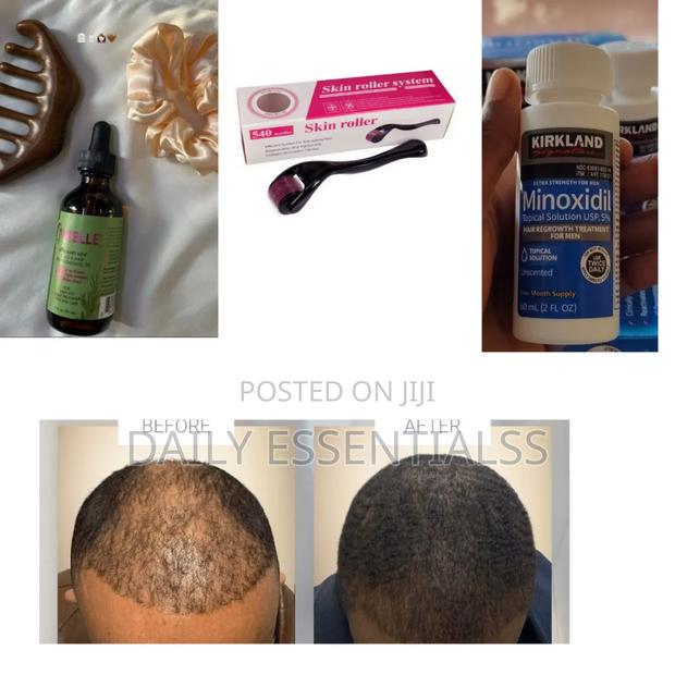 Kirkland Mielle Growth Set With Derma Roller · Photo 2